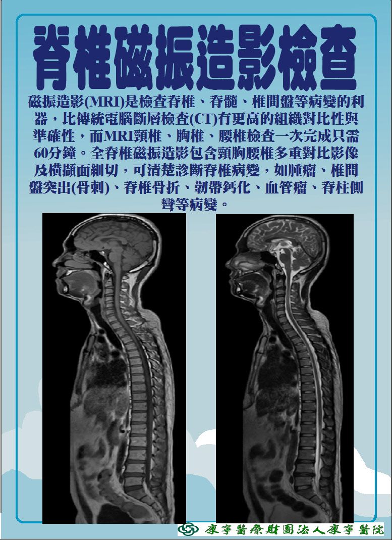 MRI-脊椎